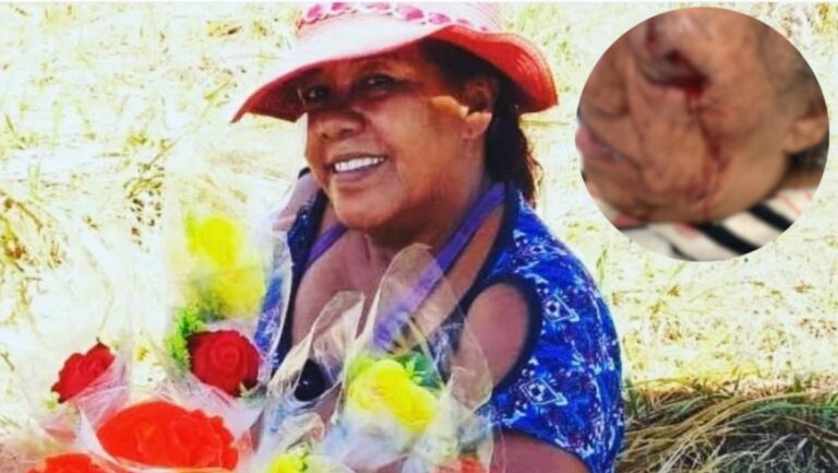 Leia mais sobre o artigo Florista de 63 anos corre risco de perder a visão após intervenção policial em Campo Grande