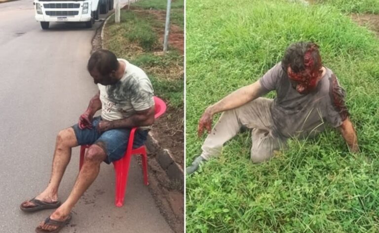 Leia mais sobre o artigo Explosão de pneu em caminhão-tanque deixa dois feridos no Posto Fiscal de Sonora(MS)